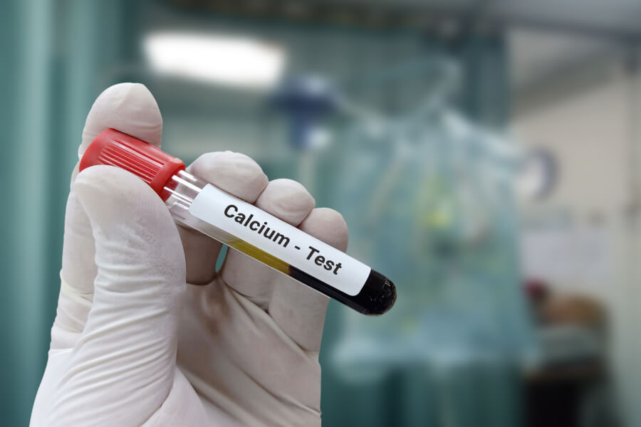 В чем разница между общим, ионизированным и альбуминсвязанным кальцием?